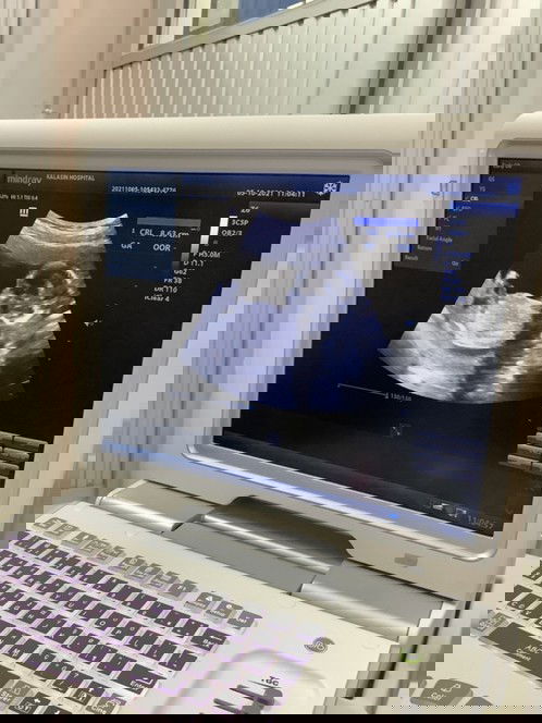 แม่ๆช่วยดูหน่อยค่ะว่าเพศไหน ดูไม่ออก