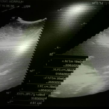 #ท้องแรก​ #แยากทราบ​เพศลูก