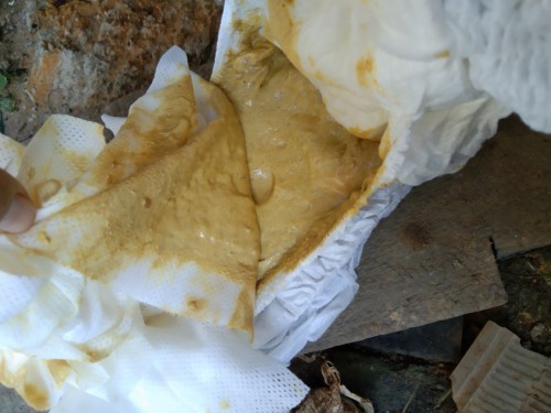 น้องถ่ายแบบนี้ท้องเสียไหมหรือกินนมผงไม่ถูกค่ะ