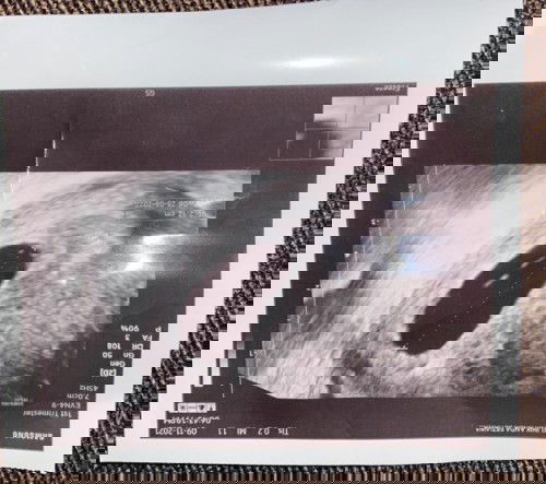 Scan kantung saja belum nampak Dan seperti panjang cm tu