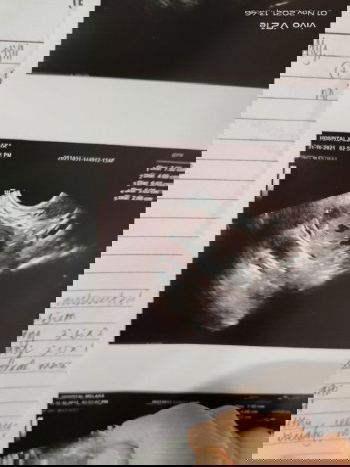 Nak tanya ibu2 yg ada pengalaman