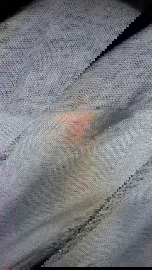 Spotting on 3rd Trimester