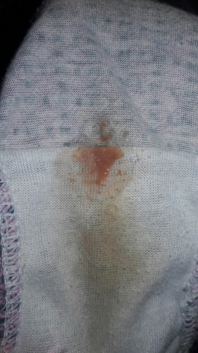 Spotting on 3rd Trimester