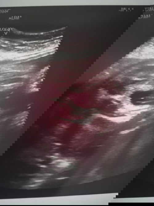 Law MCM nie mcm mane nak knl pasti boy@girl ye ade yg tahu x?