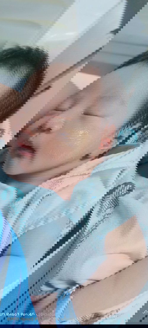 ต้าวเเก้มเยอะ