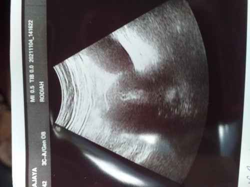 Period, bila cek upt samar