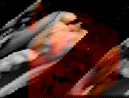 35 week Barat badan janin 2,6 kg