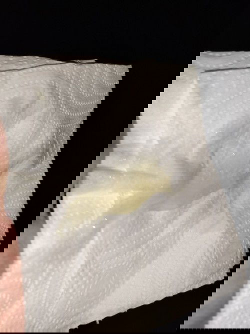 มีมูกใสออก