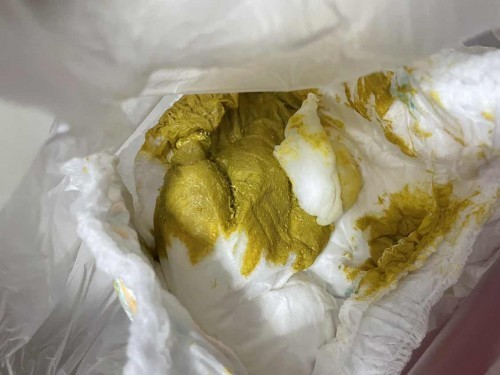 น้องๅ 1 เดือน 15 วันอึแบบนี้??