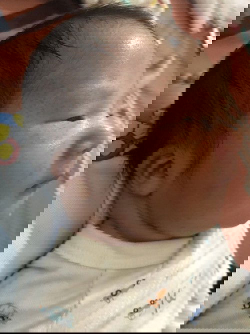 Mụn em bé khó chịu