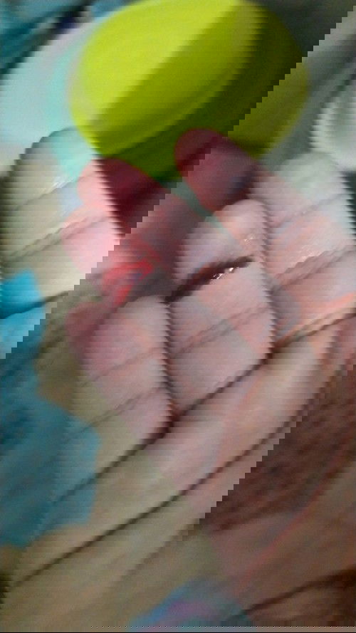 40 weeks 1 Day (Keluar Lendir + Darah)