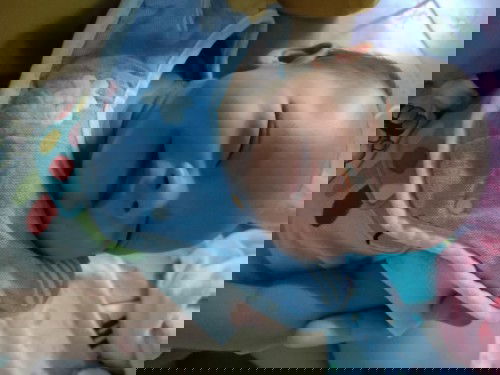 ทารก 23 วันผมร่วงเกิดจากอะไร