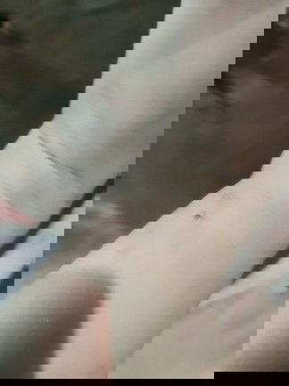 OINTMENT SA KAGAT NG LAMOK