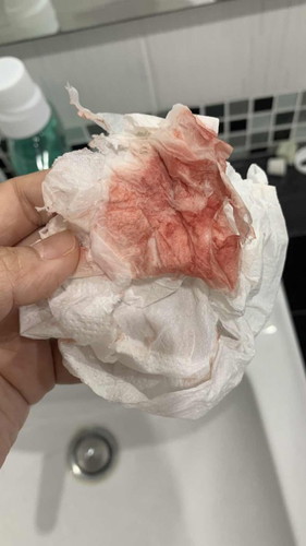 เลือดและมูกชมพูออกขณะตั้งครรภ์