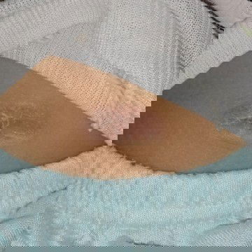 Pusar baby kering , kadang merah dan sepertinya gatal