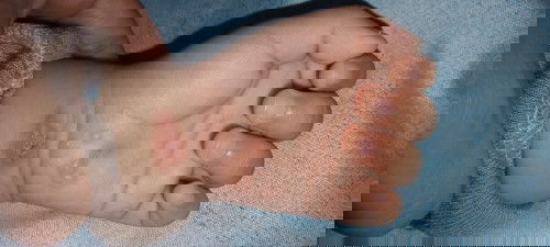 Bentol seperi kutu air