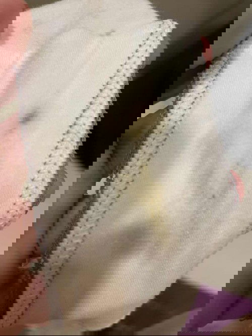 discharge color on underwear - 3rd trimester