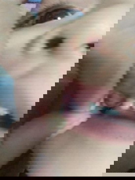 เหงือกบวมเขียว