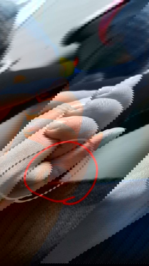 Bé khô da đầu ngón tay