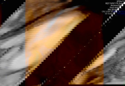 Menunggu sinyal cinta dari debay👶😚