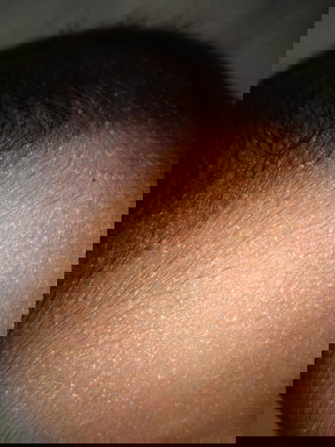 น้องอายุได้10วันค่ะ ขอถามแม่ๆหน่อยค่ะ แบบนี้น้องจะเป็นอะไรไหมค่ะ เขาเรียกว่าอะไรหรอกค่ะ ต้องไปพบแพท