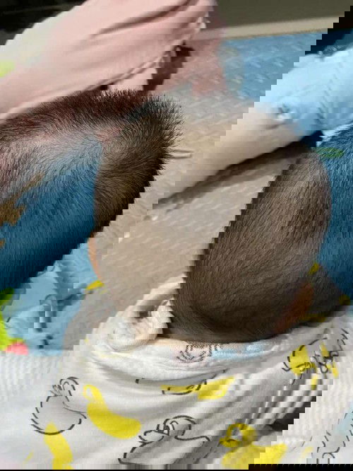 กลัวลูกหัวแบน