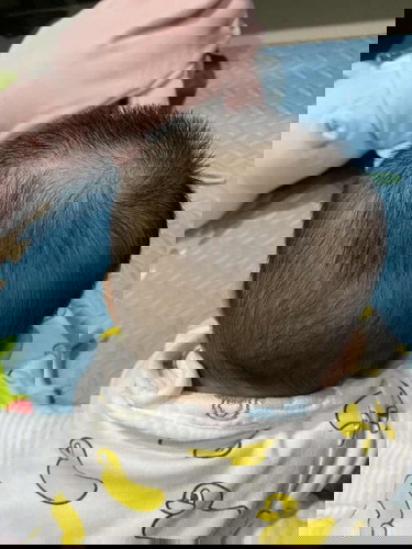 กลัวลูกหัวแบน