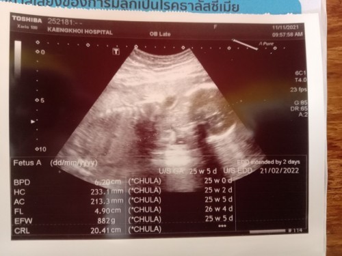 แม่ๆคนไหนทีมกุมภา65มั้งค่ะน้ำหนักลูกเท่ารัยกันแล้ว