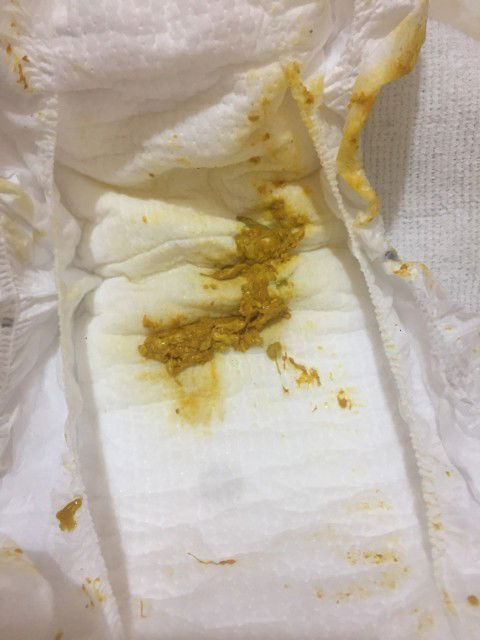 #Lan_dau_lam_me
#phan_co_chat_nhay
#Tre_so_sinh