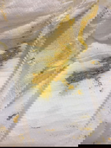 #Lan_dau_lam_me
#phan_co_chat_nhay
#Tre_so_sinh