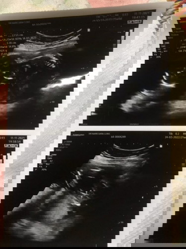 ผมเป็นผู้ชายคับ ทีมมีนา65