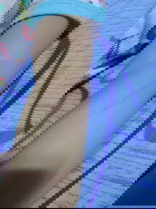 kalmot ng aso wala pang anti rabies