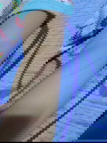 kalmot ng aso wala pang anti rabies