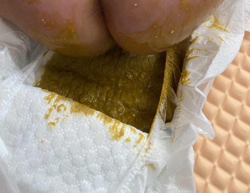 Hi mummies! Urgently need opinion. Is watery stool normal after immunisation and rotavirus vaccine? N hw long will last?