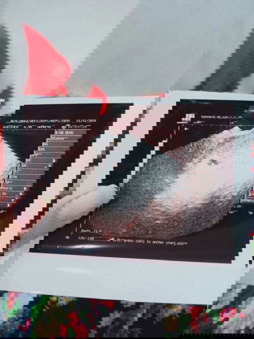 ขอสอบถามแม่ๆหน่อยค่ะ
บ้านนี้ไปซาวด์หมอบอกท้อง 5 ,W 6 วันค่ะ