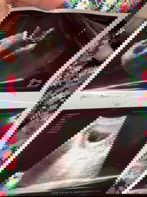 Scan baby tenggelam timbul