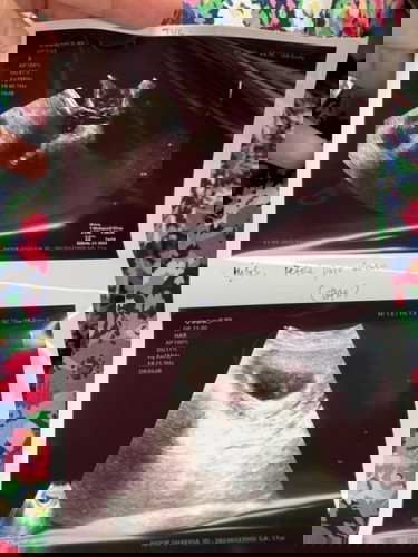 Scan baby tenggelam timbul