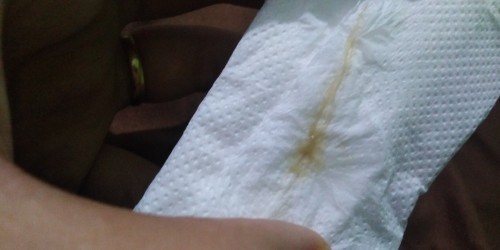 Normal lang po ba ung ganitong discharge? 8 weeks pregnant po ako