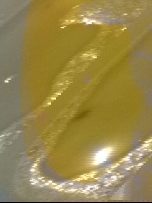 Bleed /32 weeks pregnant