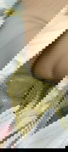 FASES BAYI BERWARNA HIJAU