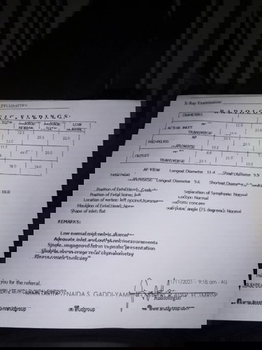 Sana po may makapansin ng tanung ko
