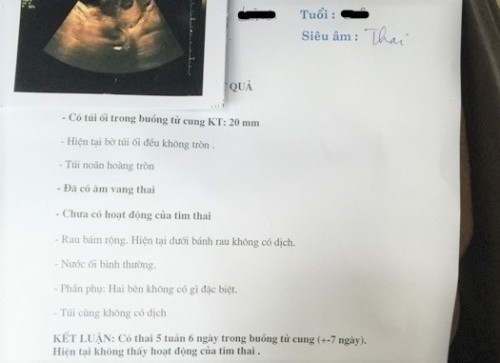 cho e hỏi có túi thai là có bầu chưa?