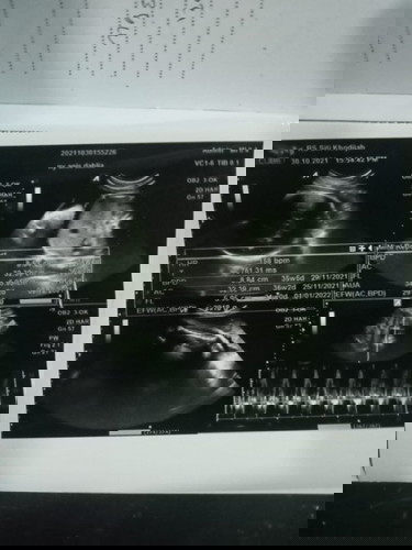 Bun mau tanya hplnya tgl brpa ya ko disitunya ada bnyk tgl, sdangkan sya mau SC, SMA BB jbnya yg mna