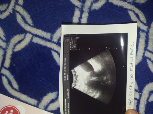 Upt samar, scan ada kantung kecil