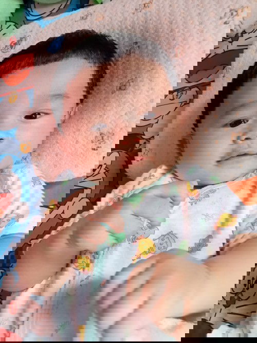 ลูกชอบนอนหงาย หัวแบนมาก ทำไงดีคะ