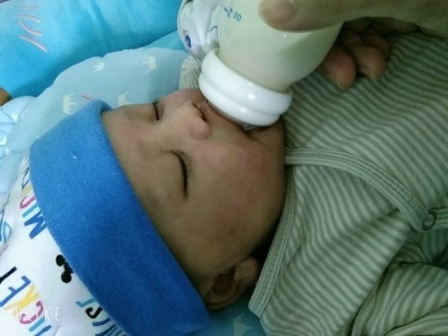 แก้มน้องเป็นผืนแดงทั้ง2ข้าง เรยค่ะ