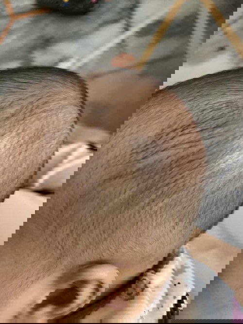 Rambut baby lambat tumbuh