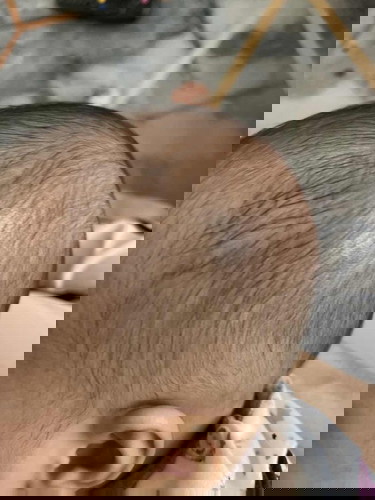 Rambut baby lambat tumbuh