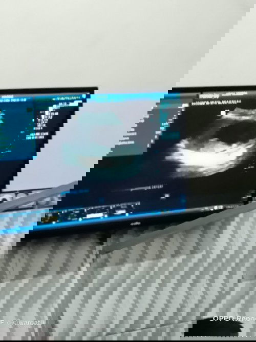 Cara mengetahui bayi cewek apa cowok? Soalnya pas USG dedenya gak kelihatan🙏