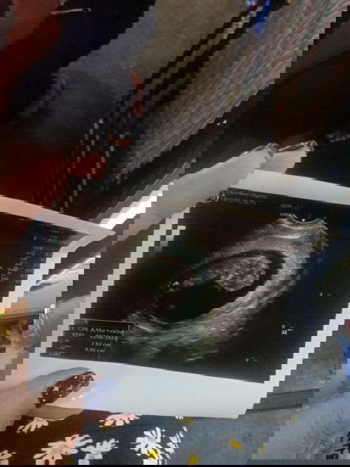 น้องนอนแบบนี้แปลกไหมคะ